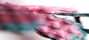 Eine Makrofotografie mit rosa, grau-grünen Farben von Iris Schlichte.